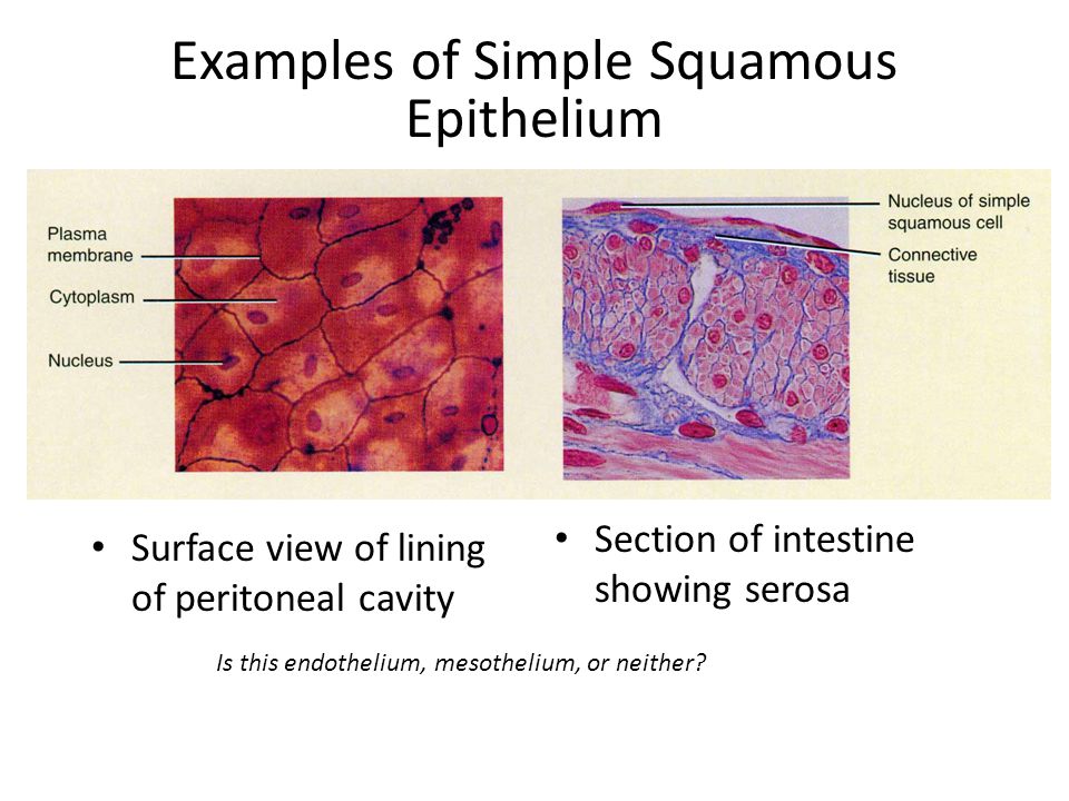 Examples of Simple Squamous Epithelium